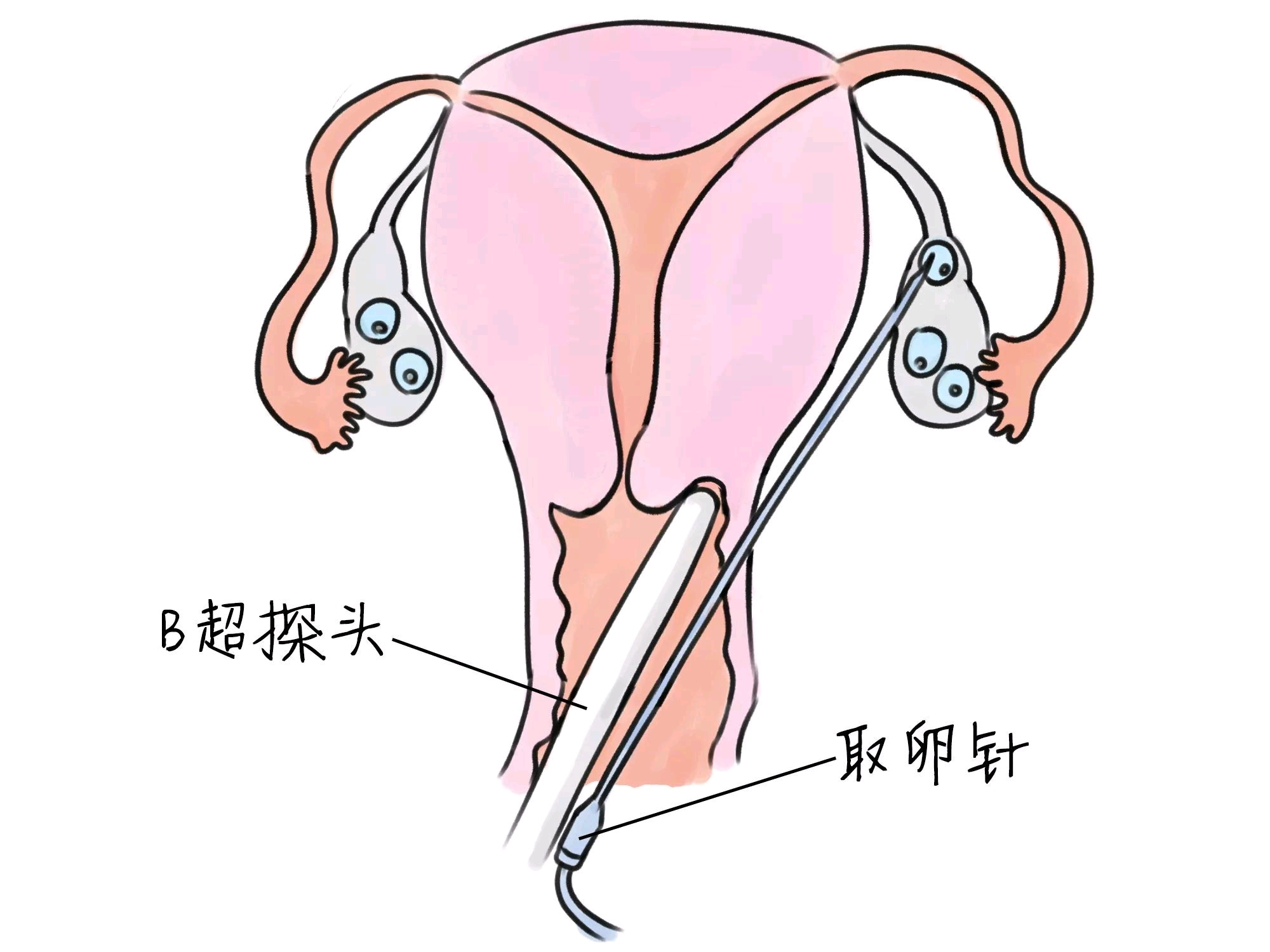 去医院体验分娩
