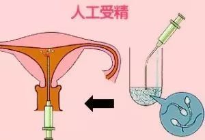 南京小产假期
