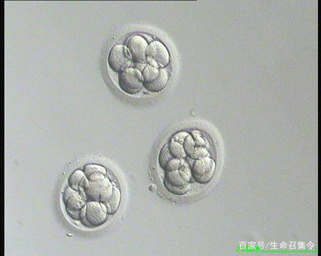 孕检