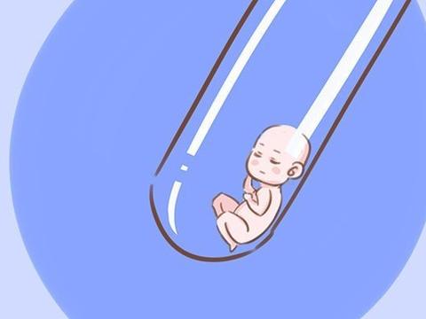 卵巢囊肿