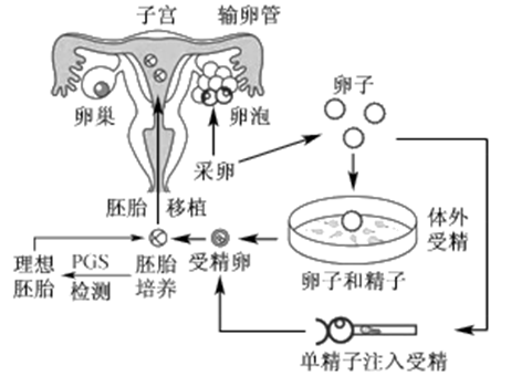 孕检