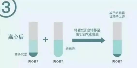 人流手术