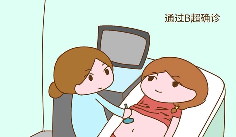 孕前检查