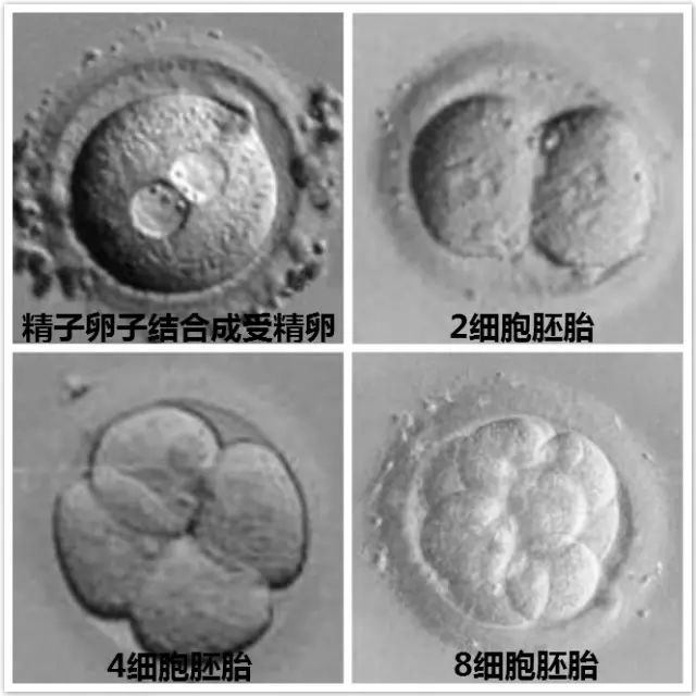 怀孕检查